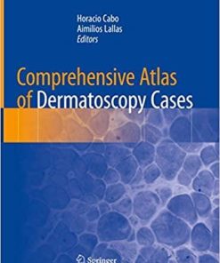 Comprehensive Atlas of Dermatoscopy Cases 1st ed. 2018 Edition
