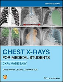 1590997817 498569983 chest x rays for medical students cxrs made easy 2nd edition