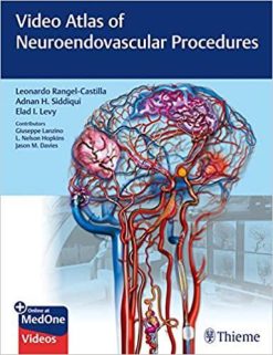1590998658 347194582 video atlas of neuroendovascular procedures 1st edition