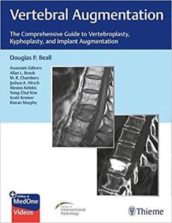 1590998791 1577774539 vertebral augmentation the comprehensive guide to vertebroplasty kyphoplasty and implant augmentation 1st edition