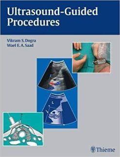 1598934791 2091556190 ultrasound guided procedures illustrated
