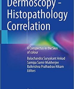 Dermoscopy – Histopathology Correlation: A Conspectus in the Skin of colour 1st ed. 2021 Edition