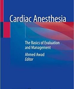 Cardiac Anesthesia: The Basics of Evaluation and Management 1st ed. 2021 Edition
