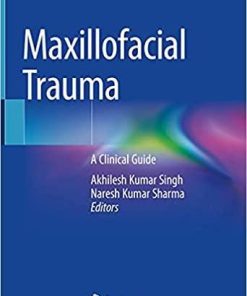 Maxillofacial Trauma: A Clinical Guide 1st ed. 2021 Edition