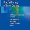 Manual on Image-Guided Brachytherapy of Inner Organs: Technique, Indications and Evidence 1st ed. 2021 Edition