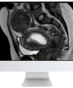 ARRS Abdominal MRI: Practical Applications and Advanced Imaging Techniques 2021
