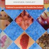 Dermatology Made Easy (PDF)