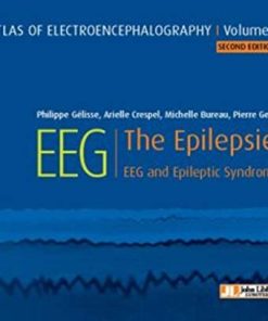 Atlas of electroencephalography:The Epilepsies. EEG and epileptic syndromes Vol 2 (ePub+Converted PDF)