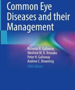 Common Eye Diseases and their Management, 5th Edition (EPUB)