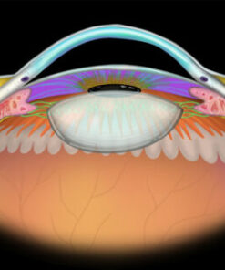 MRIOnline Imaging Mastery Series Orbit 2019 (CME VIDEOS)