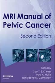 MRI Manual of Pelvic Cancer