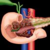 MRIOnline Imaging Mastery Series Pancreas Imaging 2021 (CME VIDEOS)