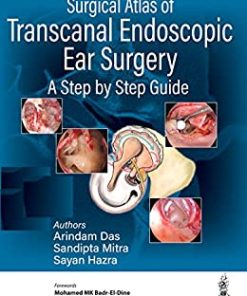 Surgical Atlas of Transcanal Endoscopic Ear Surgery: A Step by Step Guide (PDF)