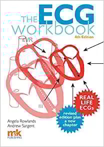 The ECG Workbook, 4th Edition (PDF)