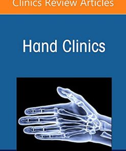 Use of Sonography in Hand/Upper Extremity Surgery – Innovative Concepts and Techniques, An Issue of Hand Clinics (Volume 38-1) (The Clinics: Internal Medicine, Volume 38-1) (PDF)