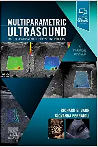 Multiparametric Ultrasound for the Assessment of Diffuse Liver Disease: A Practical Approach (PDF)