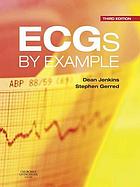 ECGs by Example, 3rd Edition (PDF)