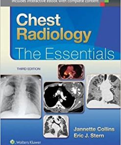 Chest Radiology: The Essentials, 3rd edition (PDF)