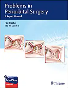 Problems in Periorbital Surgery: A Repair Manual (EPUB)