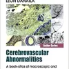 Cerebrovascular Abnormalities: A Book-Atlas of Macroscopic and Microscopic Aspects Research (PDF)