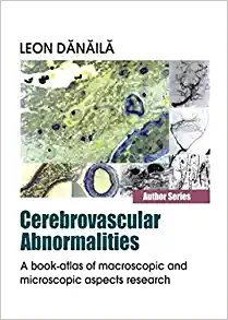 Cerebrovascular Abnormalities: A Book-Atlas of Macroscopic and Microscopic Aspects Research (PDF)