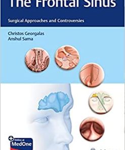 The Frontal Sinus: Surgical Approaches and Controversies (EPUB)
