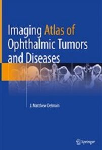 Imaging Atlas of Ophthalmic Tumors and Diseases (Original PDF from Publisher)