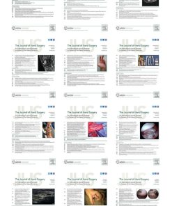 The Journal of Hand Surgery 2021 Full Archives (PDF)