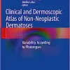 Clinical and Dermoscopic Atlas of Non-Neoplastic Dermatoses: Variability According to Phototypes (PDF)