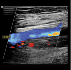 Clinical Approach to Vascular Ultrasound and RPVI Prep Course 2023 (Course)