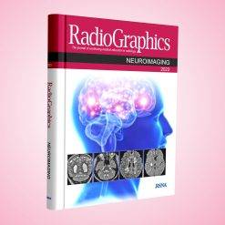 Radiographics Neuroimaging