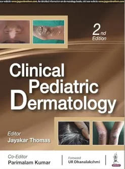 Clinical Pediatric Dermatology, 2nd Edition