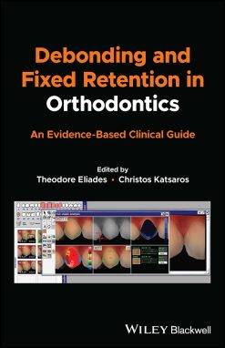 Debonding and Fixed Retention in Orthodontics (ePub Book)