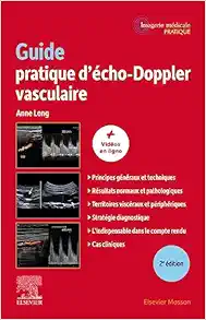 Guide pratique d’écho-Doppler vasculaire, 2nd edition (PDF Book)