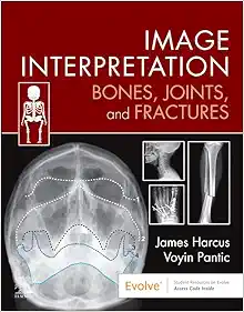 Image Interpretation: Bones, Joints, and Fractures (PDF Book)