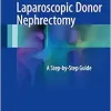 Laparoscopic Donor Nephrectomy: A Step-by-Step Guide (PDF Book)