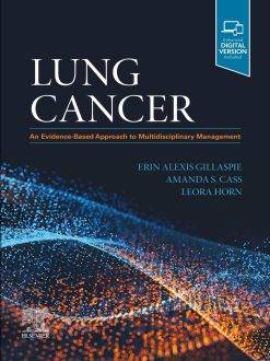 Lung Cancer: An Evidence-Based Approach to Multidisciplinary Management (ePub Book)