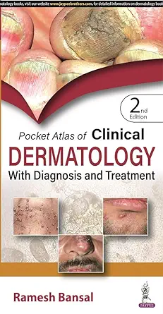 Pocket Atlas of Clinical Dermatology with Diagnosis and Treatment, 2nd Edition