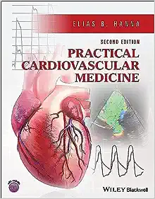 Practical Cardiovascular Medicine, 2nd Edition (ePub Book)