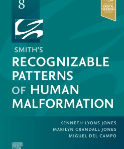 Smith’s Recognizable Patterns Of Human Malformation, 8th Edition (EPUB)