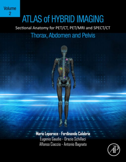 Atlas Of Hybrid Imaging Sectional Anatomy For PET/CT, PET/MRI And SPECT/CT Vol. 2: Thorax Abdomen And Pelvis: Sectional Anatomy For PET/CT, PET/MRI And SPECT/CT (EPUB)