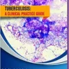 Tuberculosis: a clinical practice guide (EPUB)