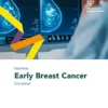 Fast Facts: Early Breast Cancer, 2nd Edition (PDF )