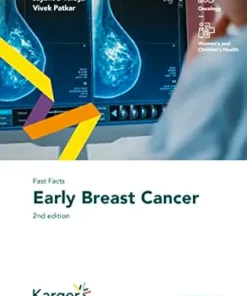 Fast Facts: Early Breast Cancer, 2nd Edition(EPUB)