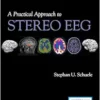 A Practical Approach to Stereo EEG (EPUB)