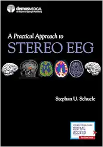 A Practical Approach to Stereo EEG (EPUB)