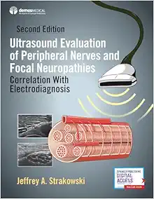 Ultrasound Evaluation of Peripheral Nerves and Focal Neuropathies, 2nd Edition: Correlation With Electrodiagnosis (EPUB)