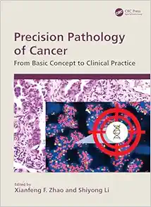 Precision Pathology of Cancer: From Basic Concept to Clinical Practice (EPUB)