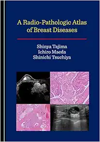 A Radio-Pathologic Atlas of Breast Diseases (PDF )