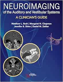 Neuroimaging of the Auditory and Vestibular Systems: A Clinician’s Guide (EPUB)